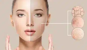 Hyaluronik Asit Serum